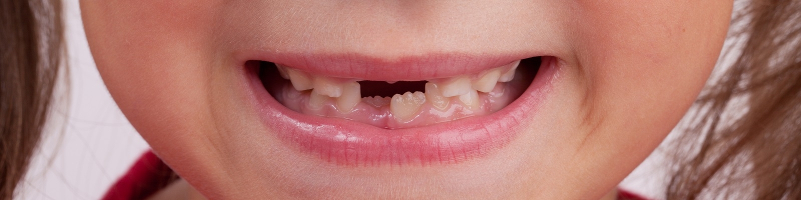 Сонник — к чему снятся зубы